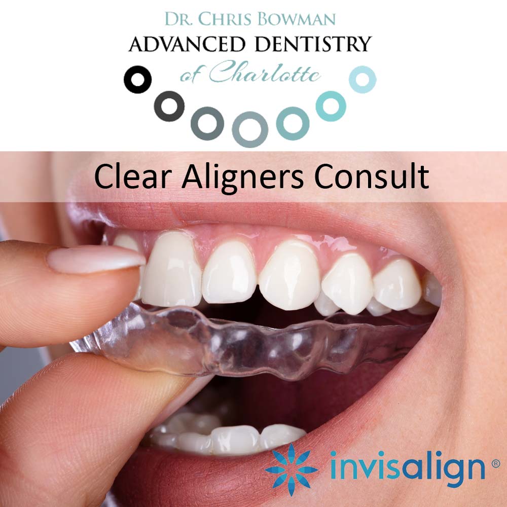 Clear Aligners Consult